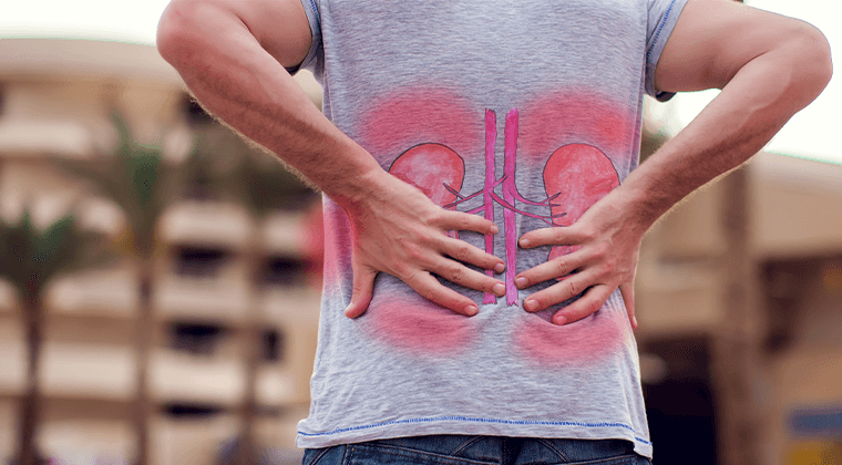 Dolor en el costado o la espalda baja (Dolor renal)