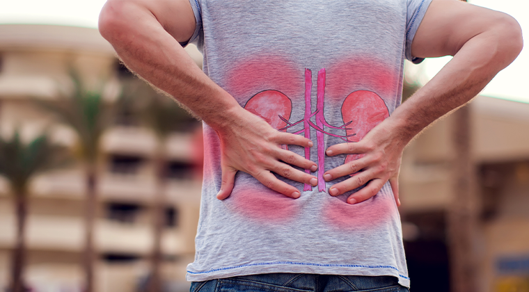 Dolor en el costado o la espalda baja (Dolor renal)